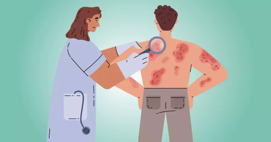 HIV Test